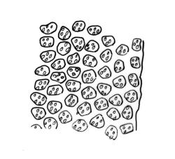 Zygodon hookeri, upper laminal cells at margin.
 Image: R.C. Wagstaff © All rights reserved. Redrawn with permission from Lewinsky (1990). 